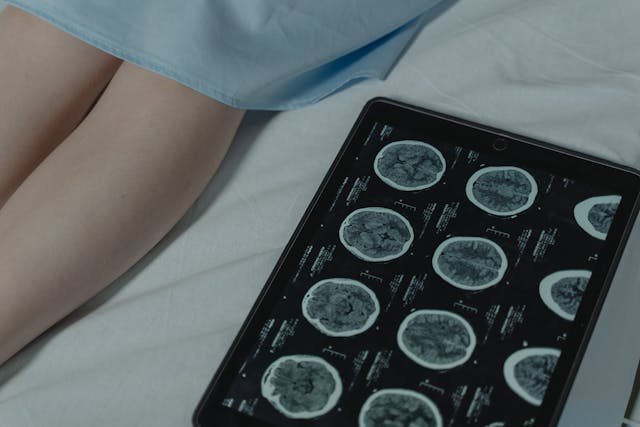 Assessing Support Needs for Individuals with Acquired Brain Injury