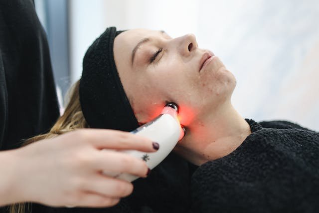 The Popularity of BBL HEROic for Skin Rejuvenation